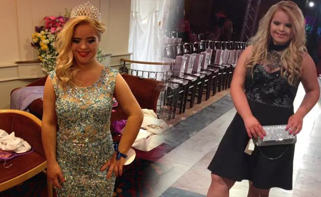 Down sendromlu model, uluslararası güzellik yarışmasını kazandı