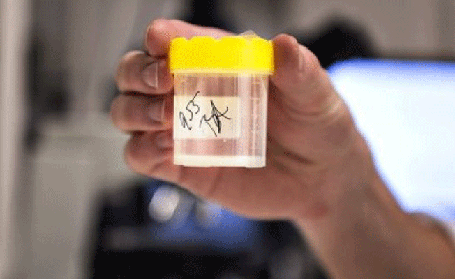 Brexit, Sperm kıtlığına neden olacak