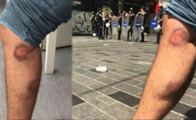 Muhabire, görevi sırasında gazlı mermili saldırı