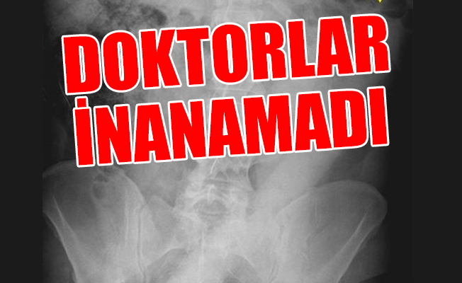 Seks fantezisi hastanede bitti