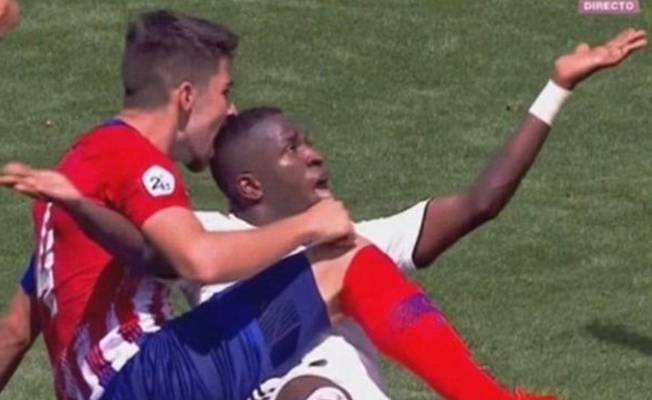 Futbolcu kafasından ısırıldı