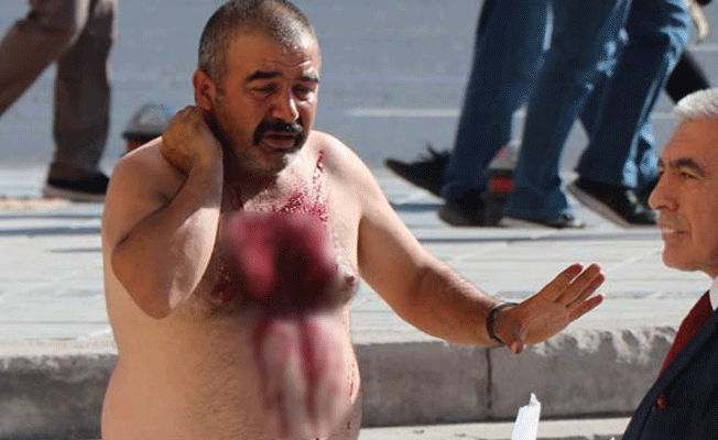 Valilik önünde dehşet anları! Jiletle kendini doğradı