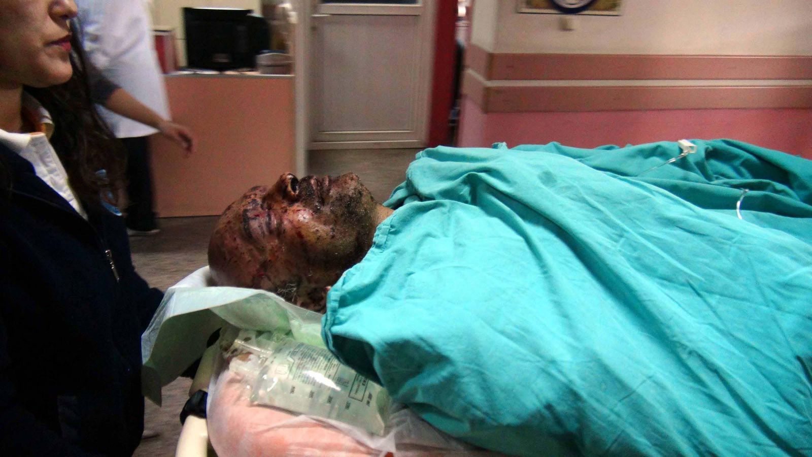 Fethiye'de esrarengiz patlama: 3 yaralı