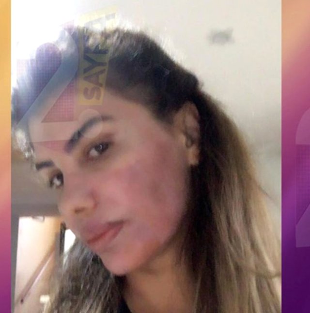 Hatice, güzelleşeyim derken yandı!