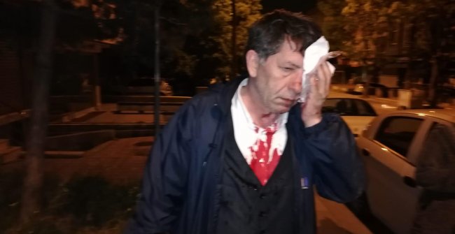 Yavuz Selim Demirağ saldırıya uğradı