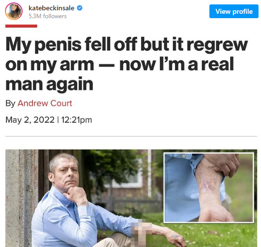 y.png