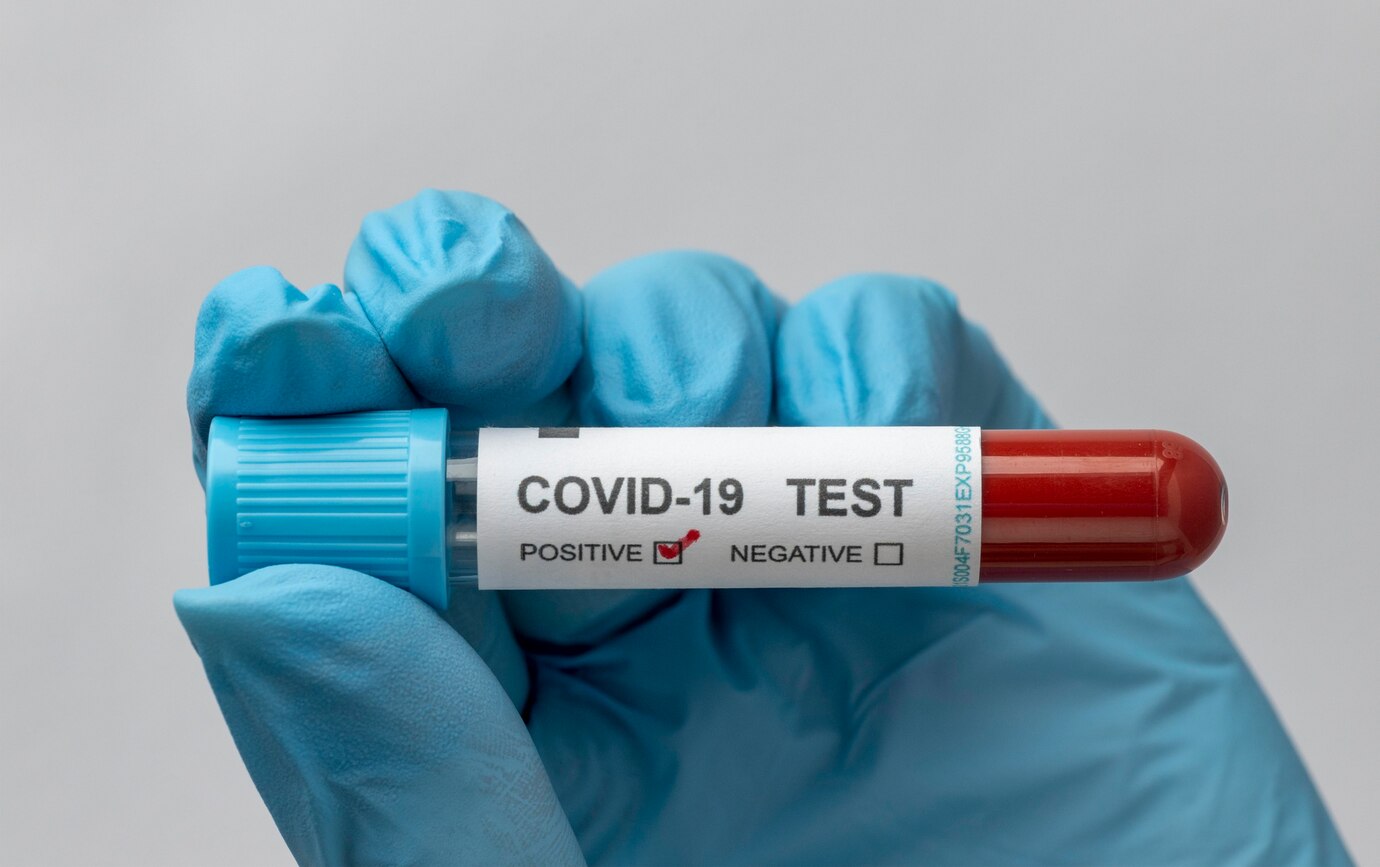 hand-with-protective-gloves-holding-blood-sample-covid-test-23-2148958349.jpg