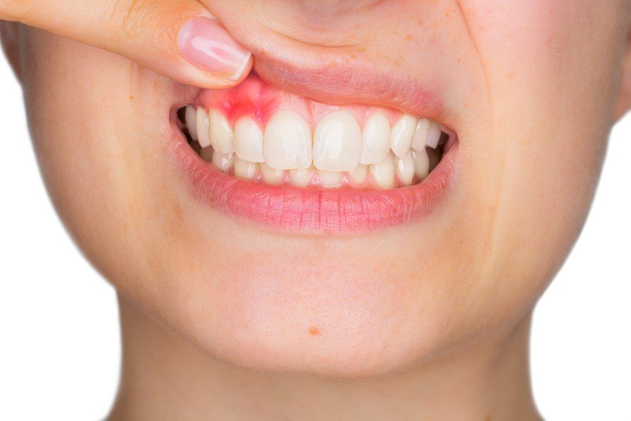 shutterstock-616331219-custom.jpg