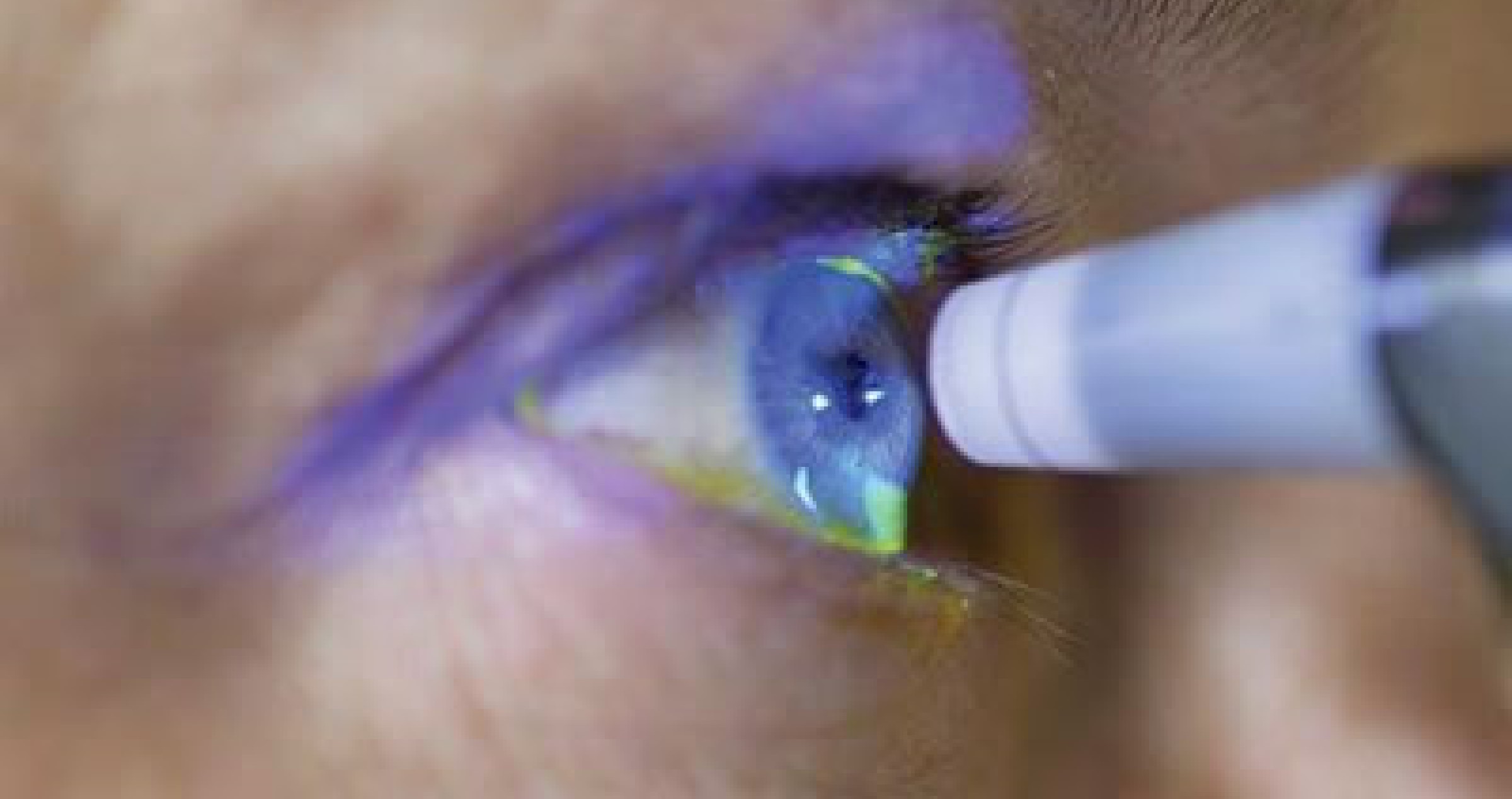 when-raised-pressure-is-not-glaucoma-2400x1268.jpg