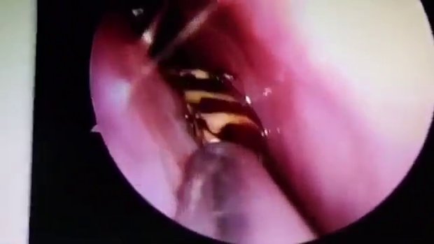 7a50435b017ed9354a60fe9b639befe3-620x349.jpg
