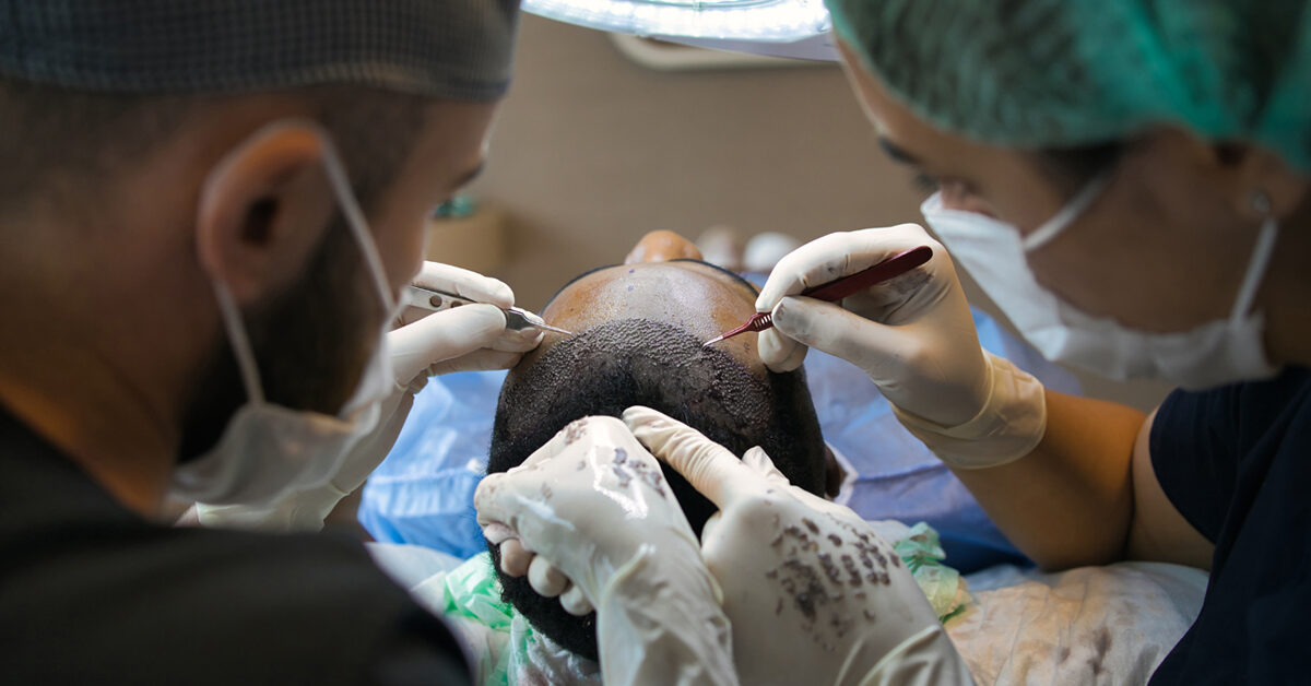 hair-transplant-procedure-1200x628-facebook-1200x628.jpg