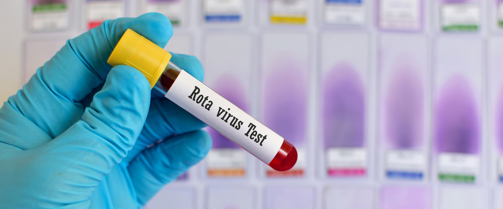 rotavirus-ishali-kis-ishali2.jpg