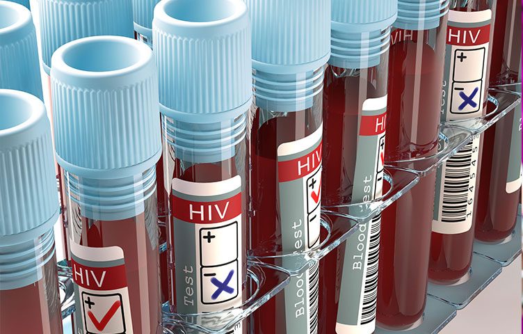 hiv-752x480.jpg