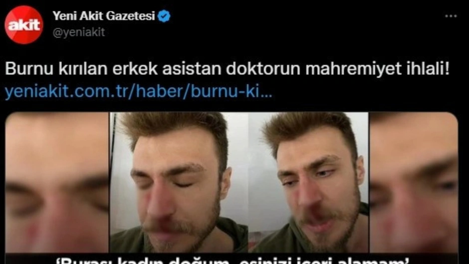 skandal-yobaz-akit-burnu-kirilan-doktoru-hedef-gosterdi-rvdf.webp