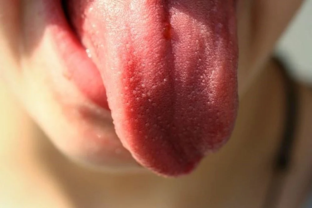 mh2ay39qqeiuredubzlozg.webp