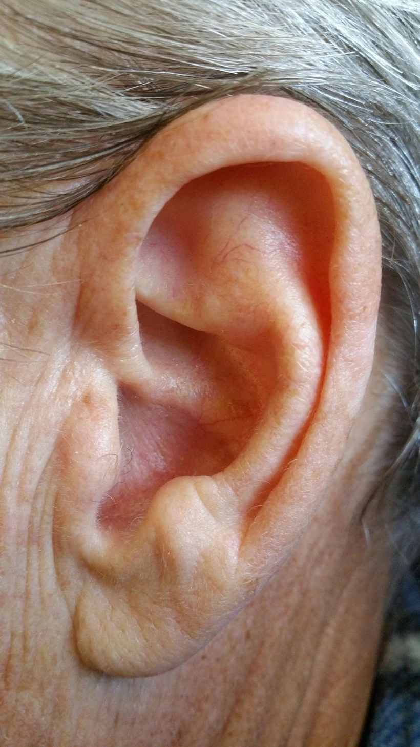 ear-1100111-1920-tg9u-5q0v.webp