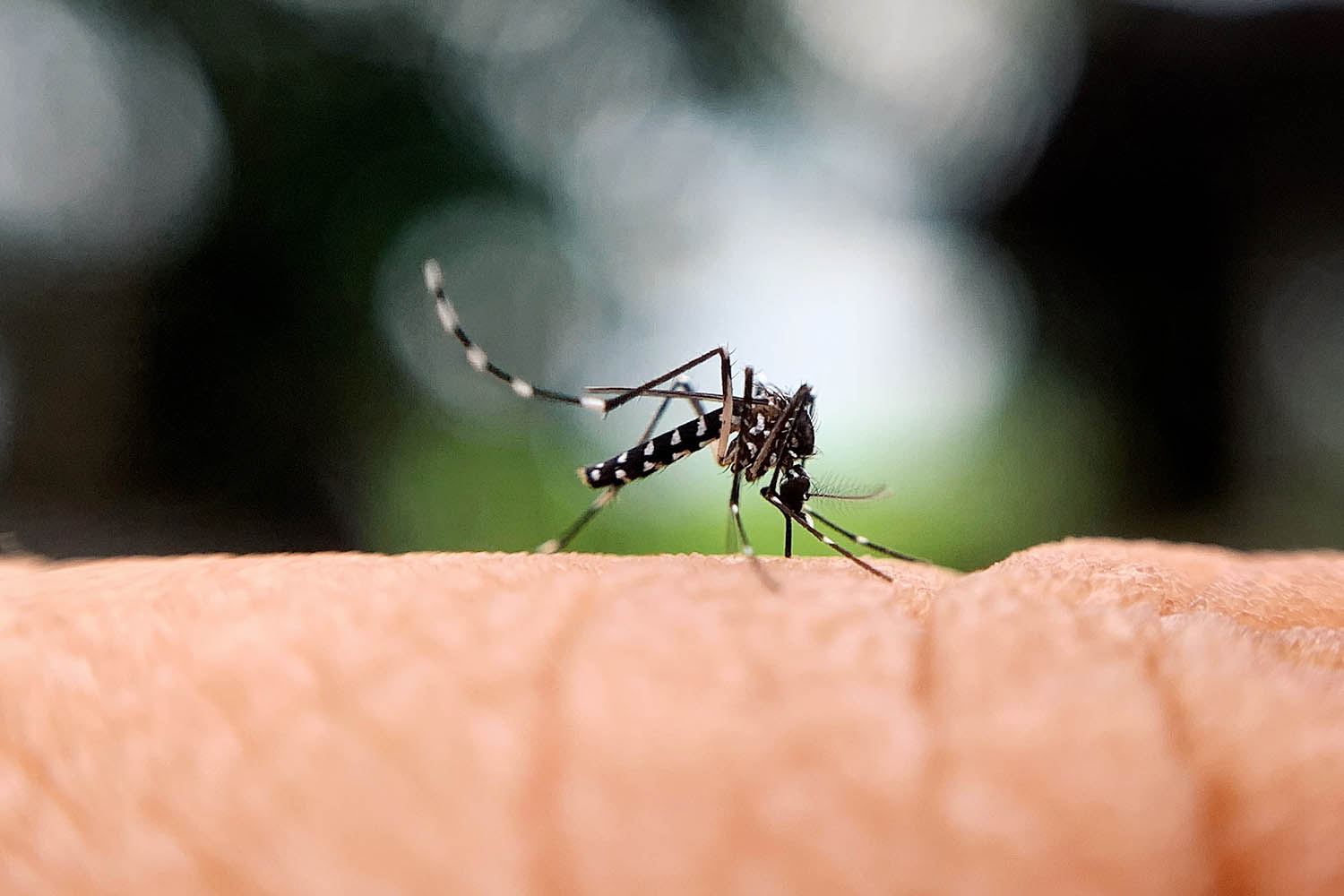 mosquito-bites-on-hand-lf93gg3.jpg