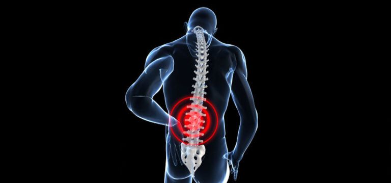 back-pain-ill-768x359.jpg