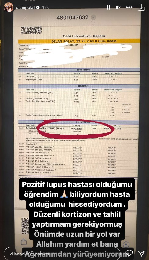 dilan-polat-lupus-hastaligina-yakalandi-16395007-7972-m-001.jpg