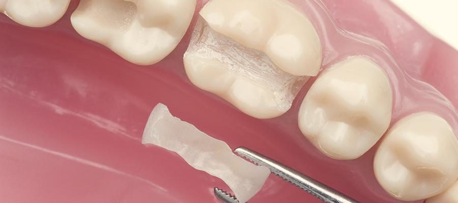 amalgam-900x400.jpg