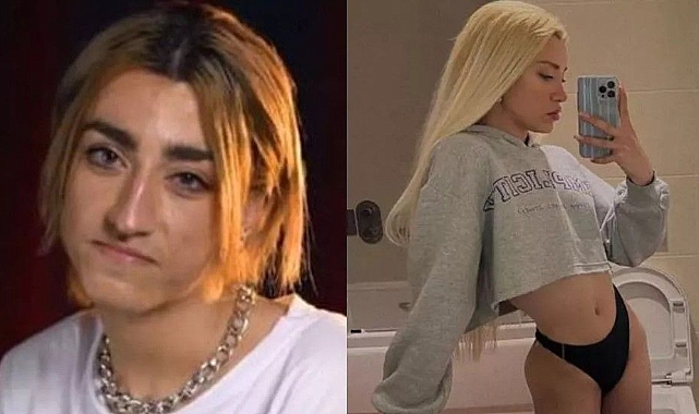 mika-raun-kestirdi-mi-mika-raun-kimdir-mika-raun-hangi-estetikleri-yaptirdi-7559.jpg