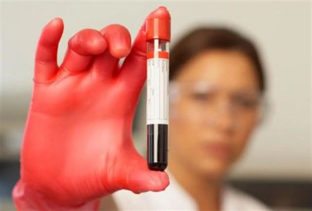 sangue-provetta-jpg.webp