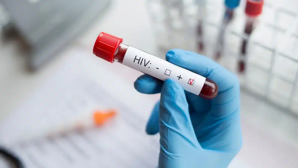 hiv-aids-jpg.webp