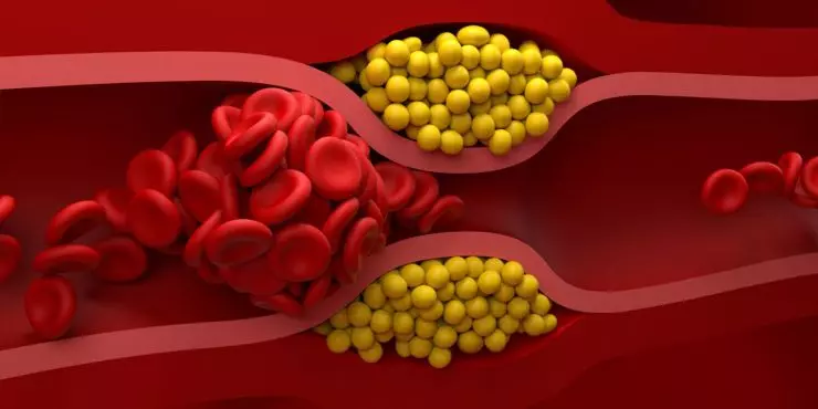 what-is-good-and-bad-cholesterol.webp