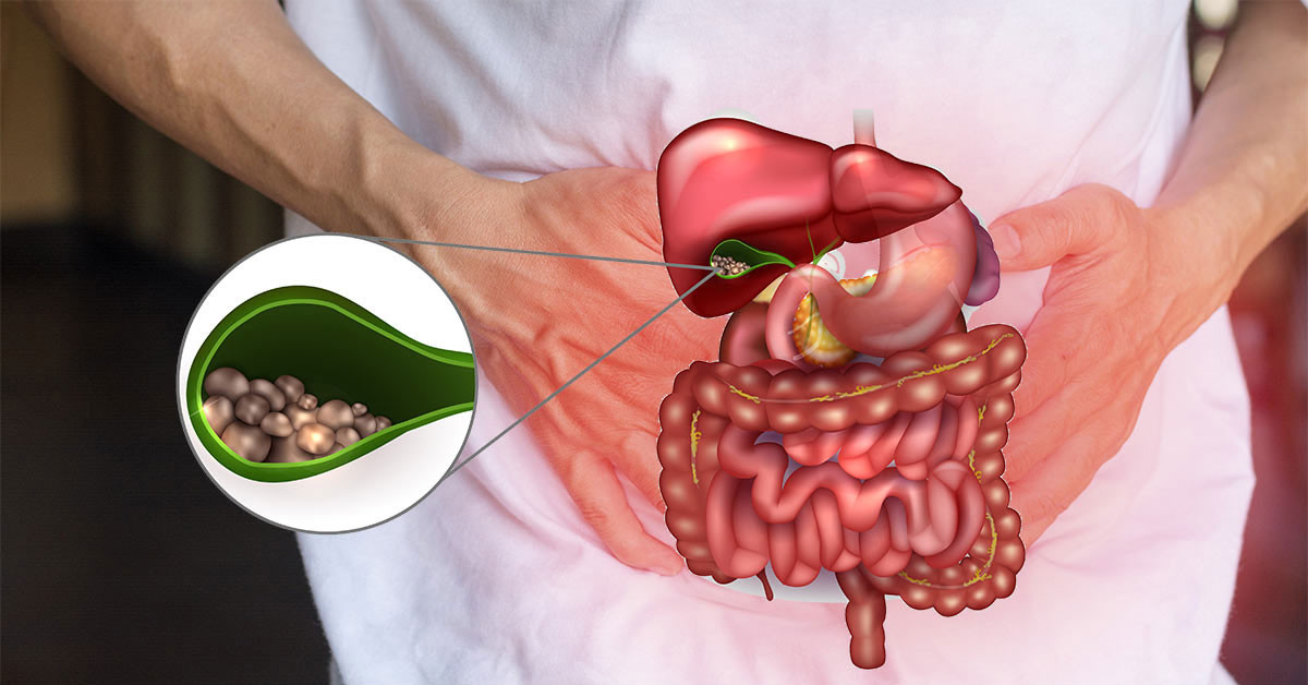 fdhsuzdz8trlqhaimj1r6kubboiffmz1-body.jpg