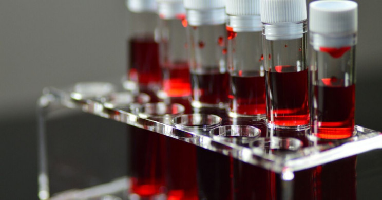 blood-types-covid-19-resize-md.jpg