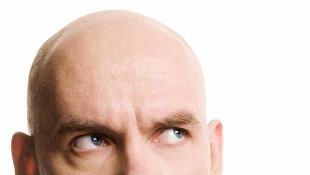 alopesi-nedir-kellik-nedir.jpg