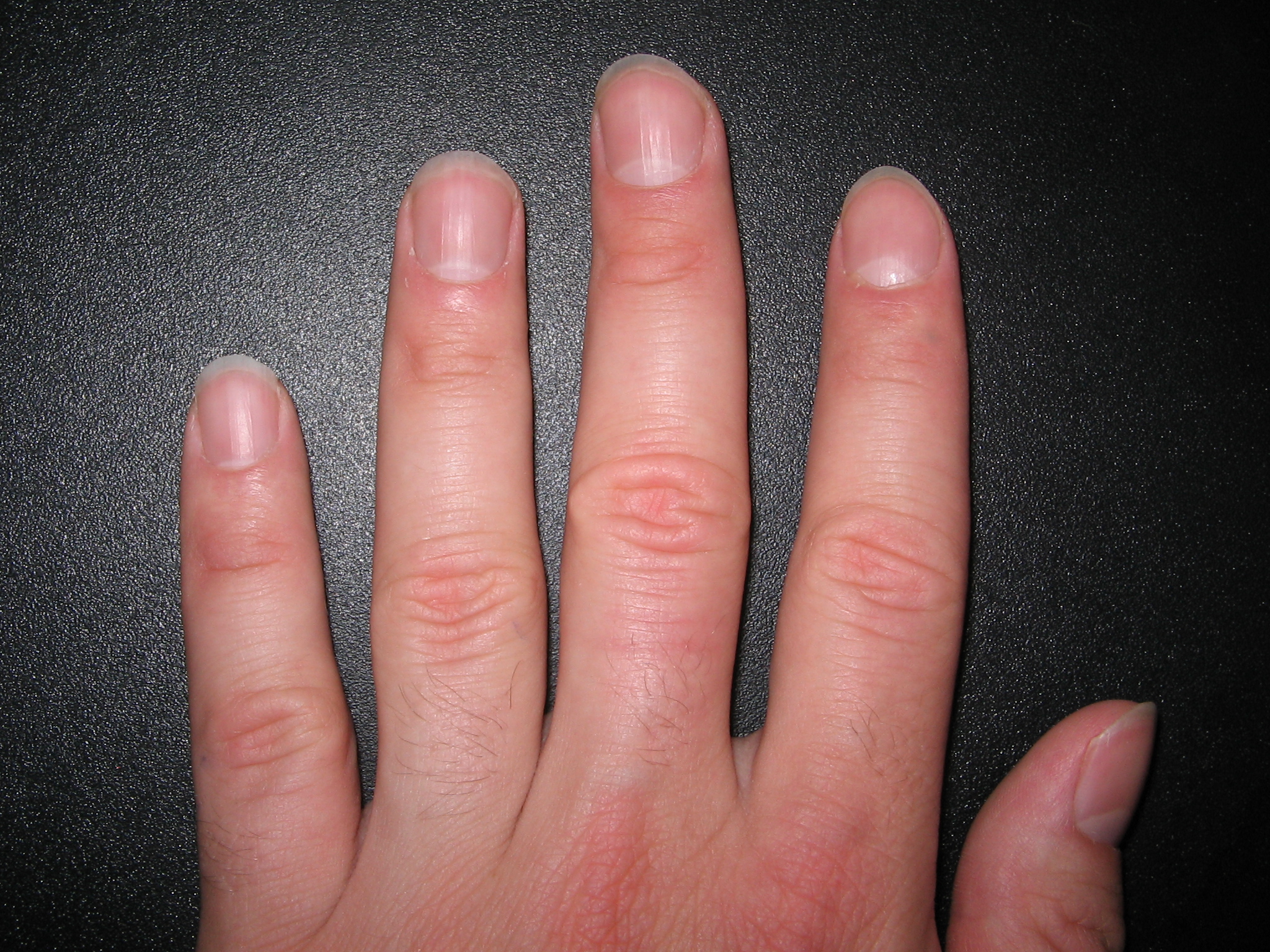 fingernails2.jpg