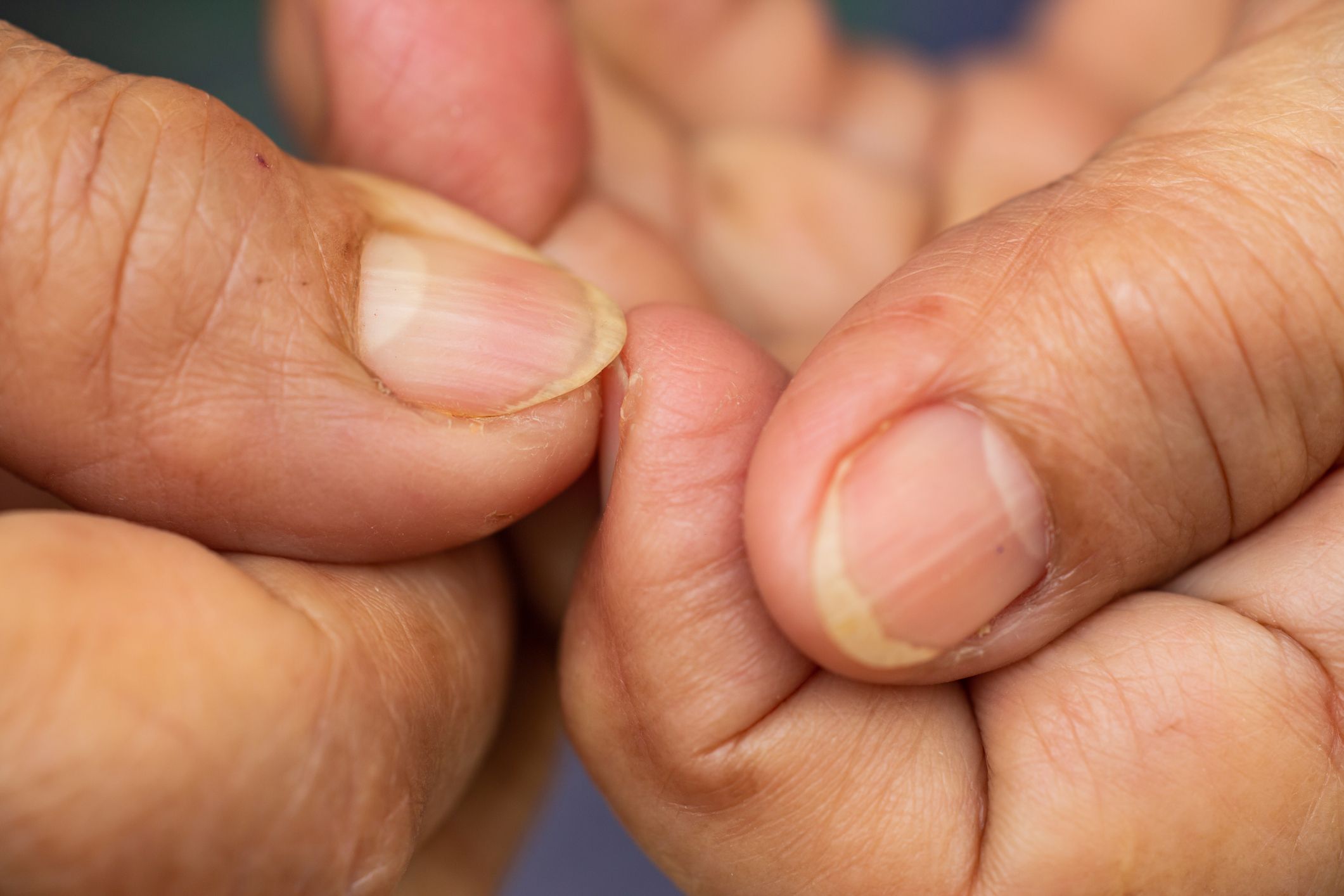 senior-woman-nibbling-her-nails-close-up-macro-shot-royalty-free-image-1568825818.jpg