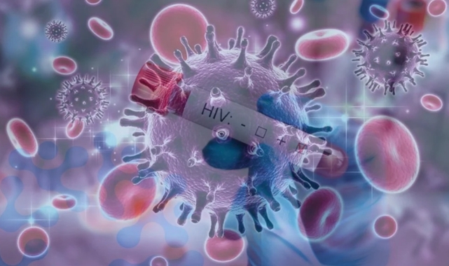 hiv-virgs-haberi-3.jpg