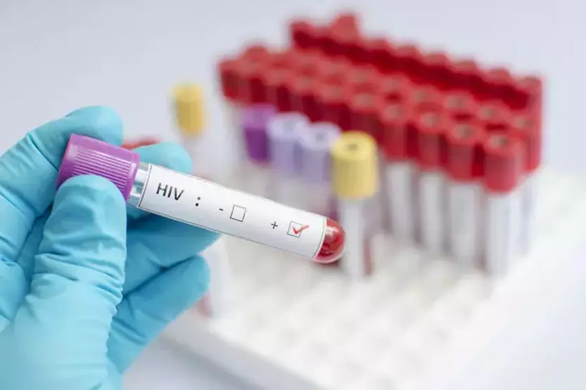 hiv-virgs-haberi-4.jpg