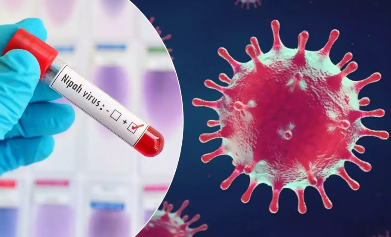 nipah-virus-2.jpg