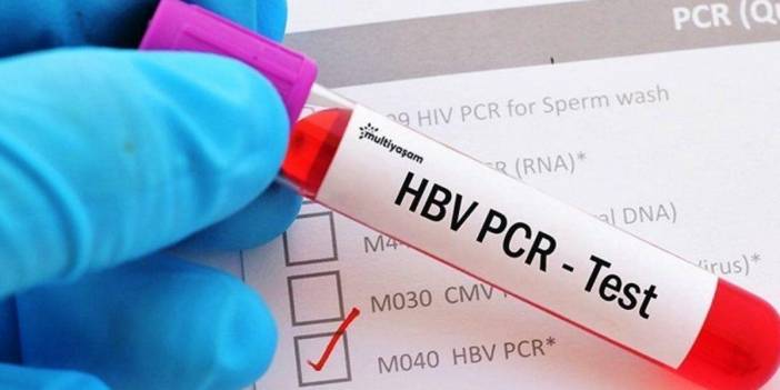 Ankara'da şok görüntüler! PCR testleri yol kenarında bulundu