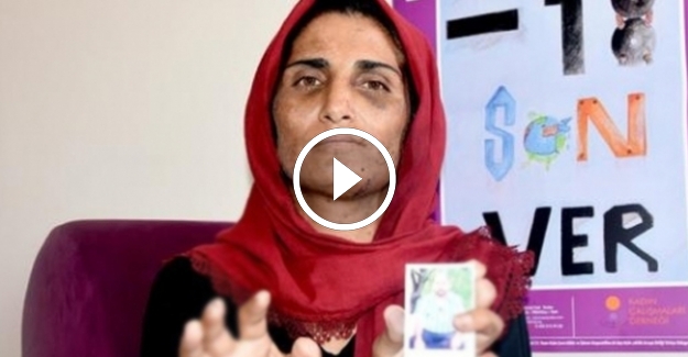 Dini nikahla evlendirilen ve kocası tarafından 11 parmağı kesilen kadına, Aile Bakanlığı sahip çıktı